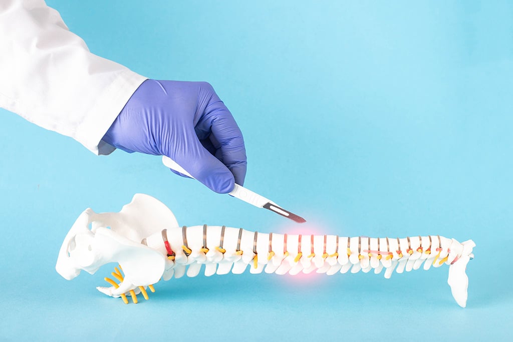 Wondering if your back pain means you need a spine surgeon?