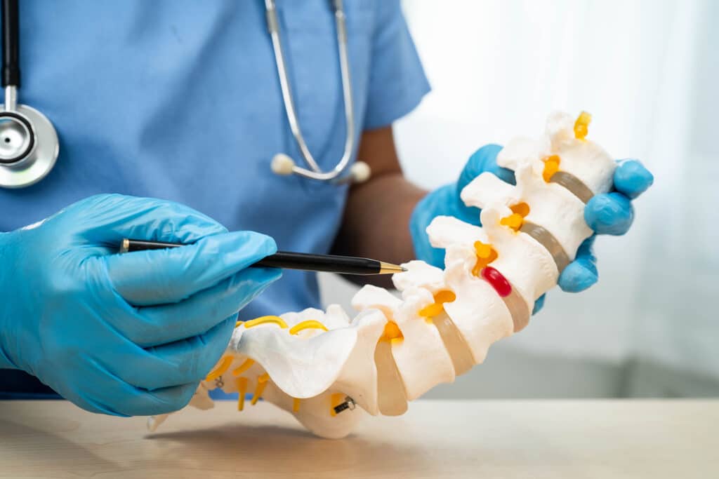 A doctor holding a diagram of a spine and diagnosing pain in the lumbar vertebrae.