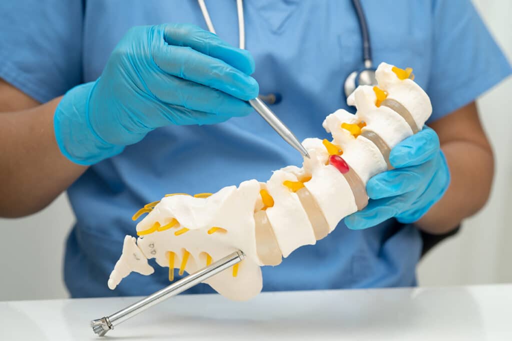 A doctor pointing to an anatomical diagram of a spine