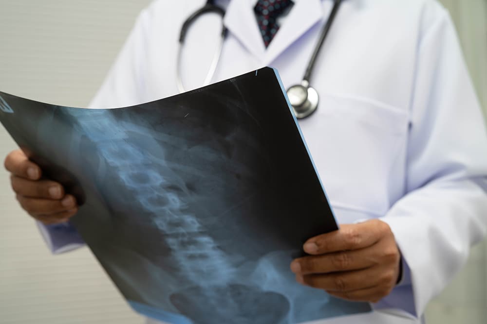 A specialist assessing an X-ray of a patient’s spine