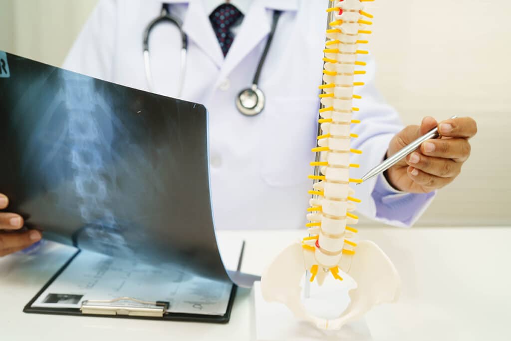 Doctor looking at an X-ray and a model of the spine