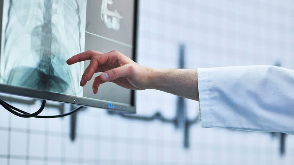 Doctor pointing at an X-ray