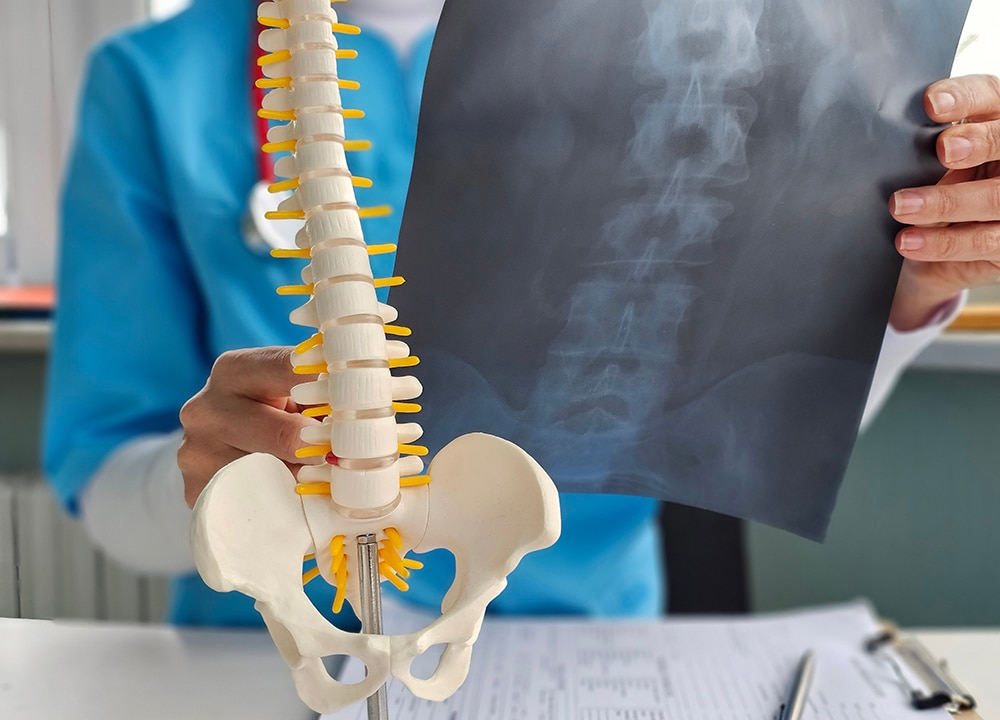 Spine specialist reviewing spinal X-rays while discussing spine surgery options.