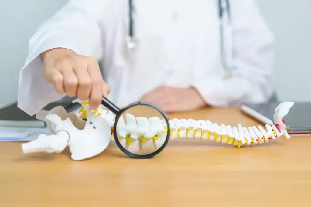 Doctor examining spine model