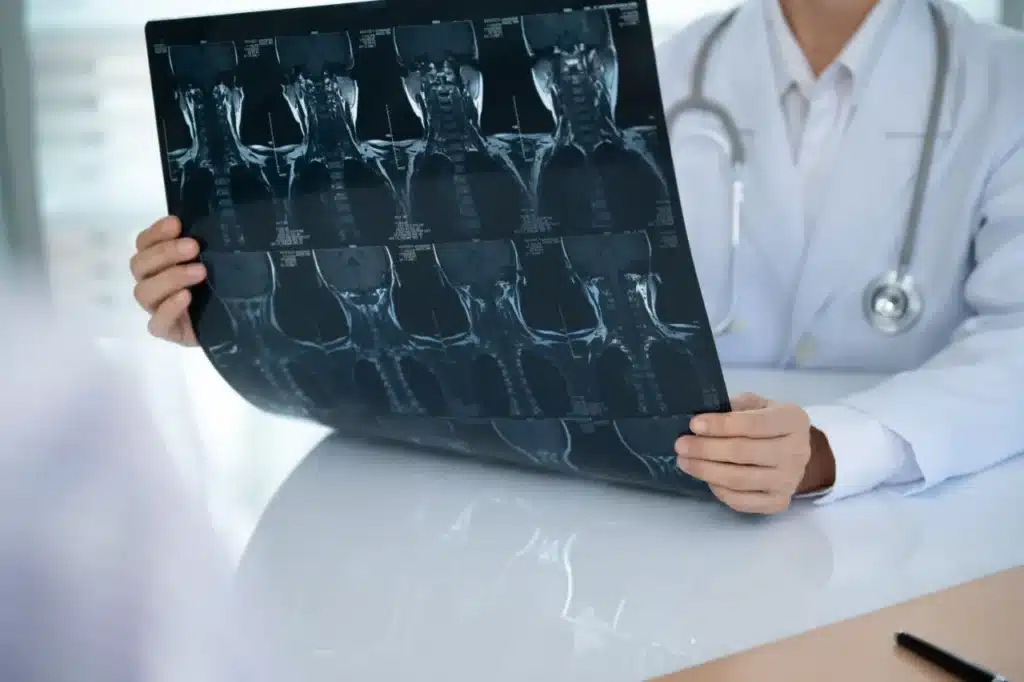 Specialist reviewing a cervical spine MRI with a patient