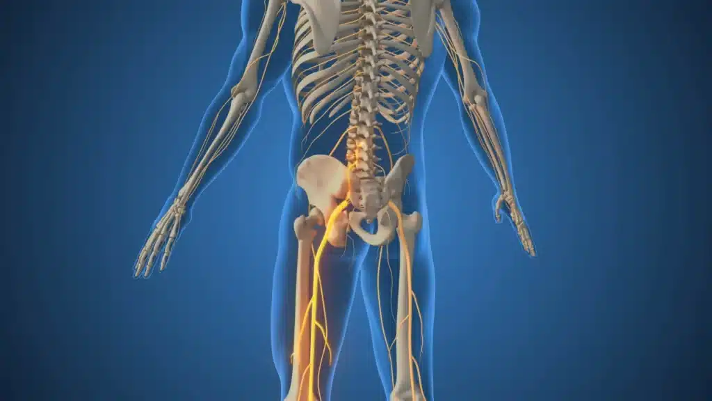 3D illustration of sciatic nerve